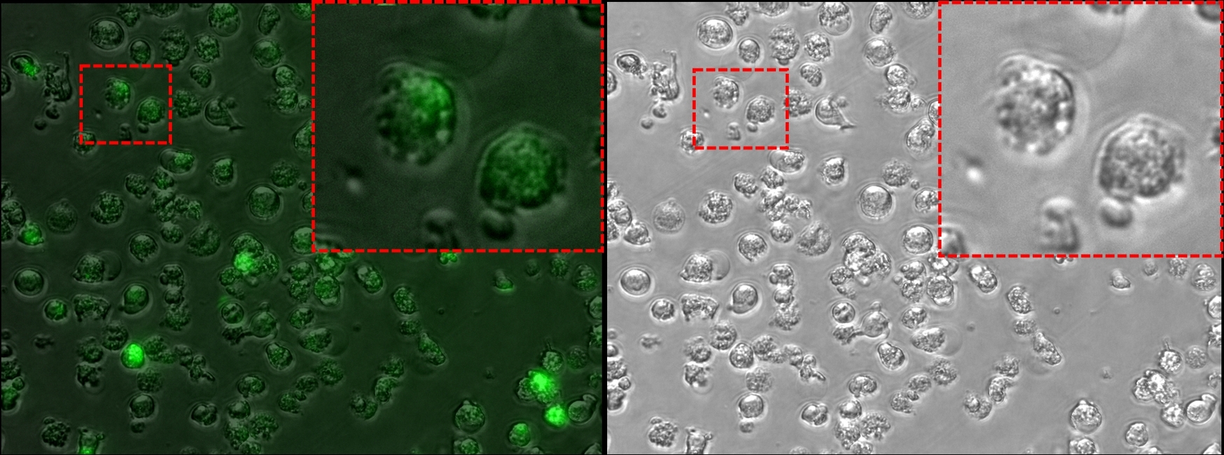 Leukemia vulnerability discovered  causing drug sensitivity
