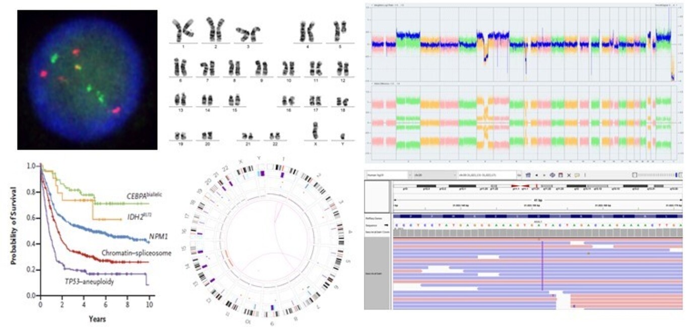 Registration is now open for the 2022 edition of the course 'Cytogenetics and Molecular Cytogenetics of Hematological Neoplasms'